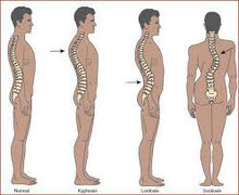 Load image into Gallery viewer, RexMar 55 – High-Grade Marine Fiber Flex Support